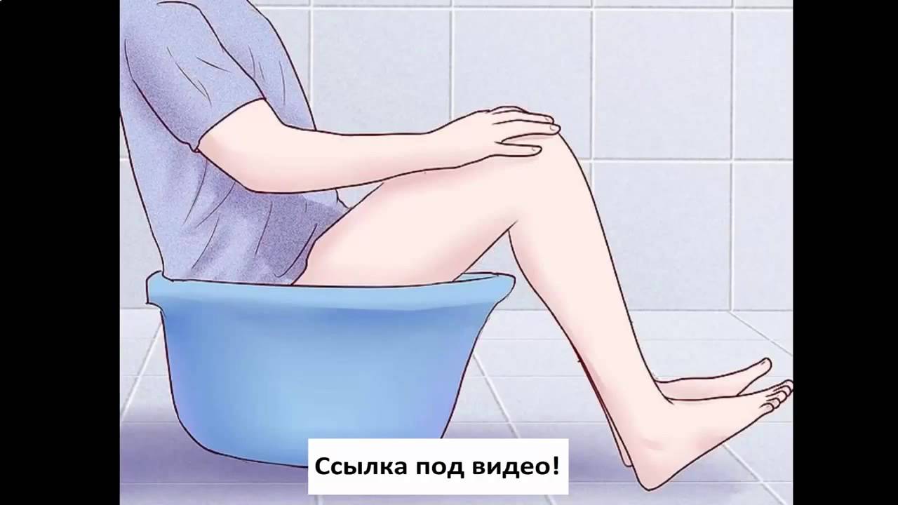 Признаки и симптомы геморроя у мужчин