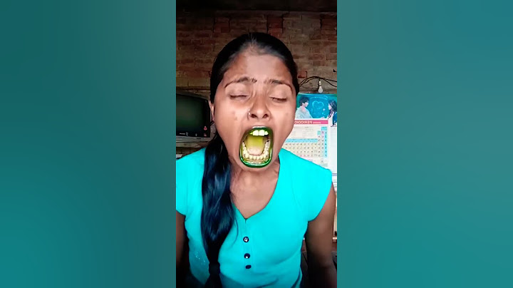 kon पड़ gaya iske piche ll chhod दो isko #funny#comedy#comedyshorts#comedyvideos