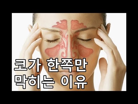 코는 왜 한쪽만 막힐까? [막힌코 뚫는법, 비염, 감기, 콧물, 코막힘]