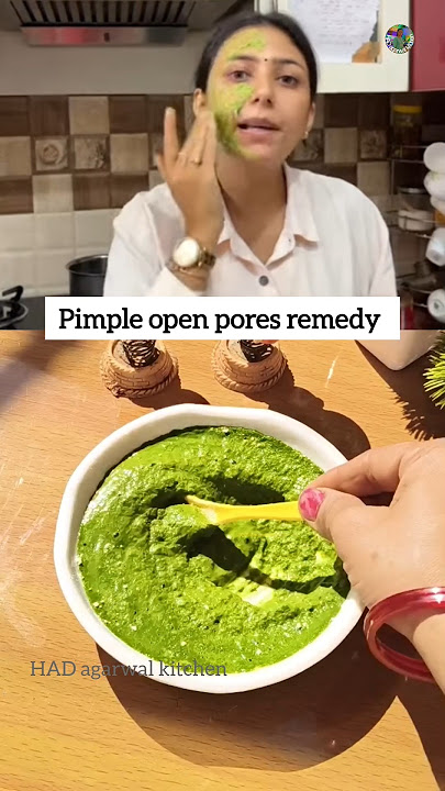 Dr. Upasana suggested a remedy pimple open pores #pimple #pigmentation #skincare #shorts