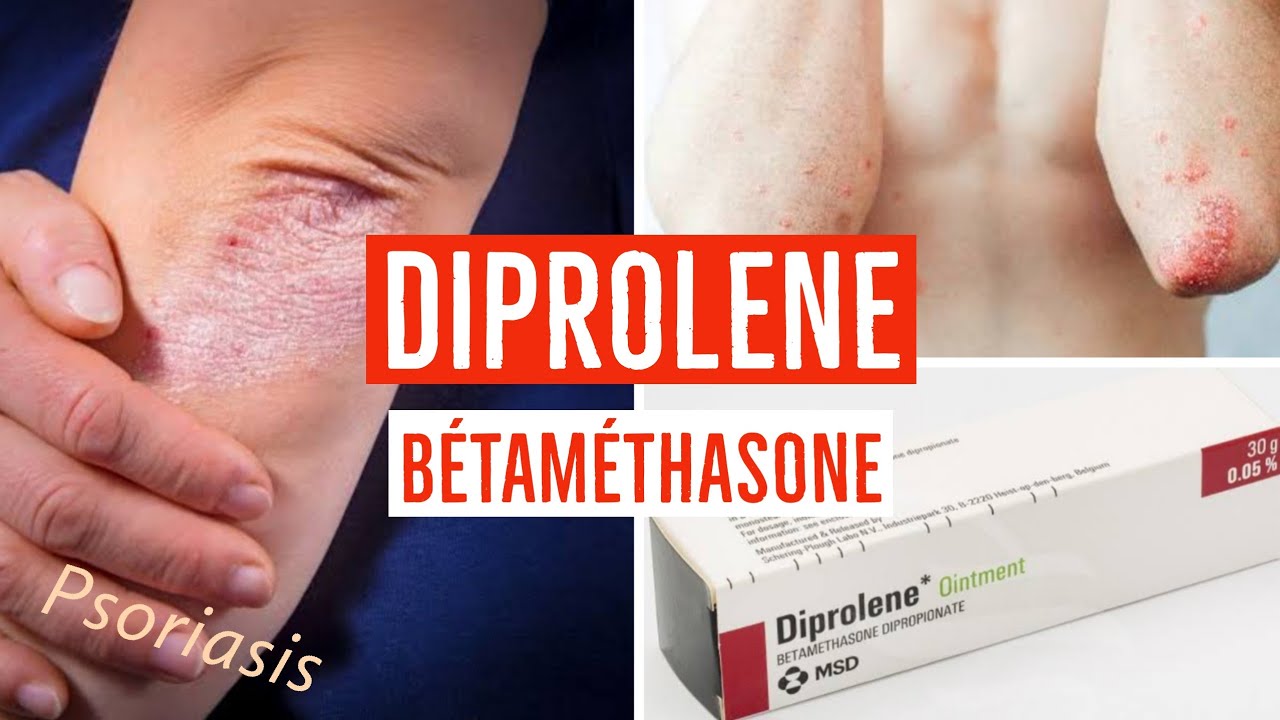 DIPROLENE 0.05 (Bétaméthasone) : crème , pommade , lotion .