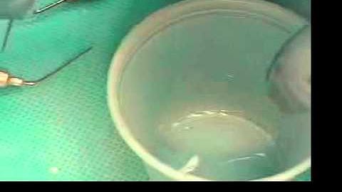 Video 05 Cleaning and shaping in a plastic tooth - using the Gates-glidden drill Part 1