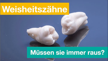 Weisheitszähne - wann sie heraus müssen?