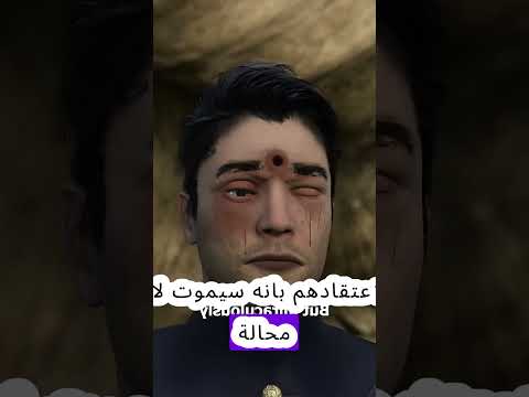 جندي ينجو من رصاصة في الدماغ