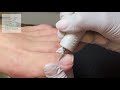 🇲🇽  Taladro de Podologia/Pedicura MEDI POWER con Aspiradora de Polvo