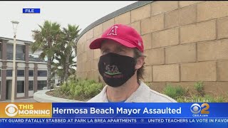 Hermosa Beach Mayor Recovering After Being Assaulted