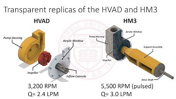 In Vitro Characterization of Ingested and Ejected Thrombus from the HM3&HVAD High-Speed Videography