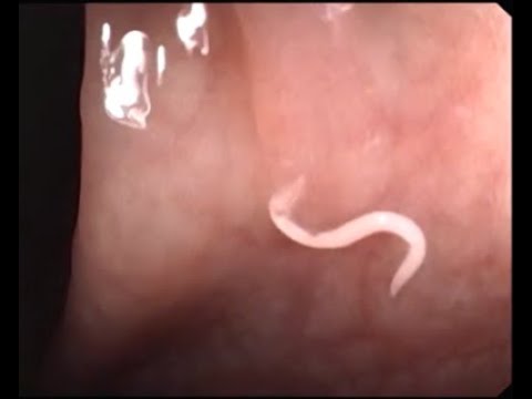 วีดีโอ: Pinworms ใน Gerbilsbil