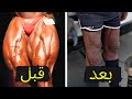 ماذا حدث لساقي روني كولمان 