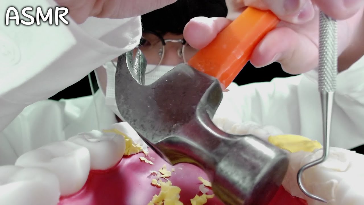 ASMR 야매 치과의사의 콰ㅋ쾅ㅋㅘㅇ쾅 치석제거