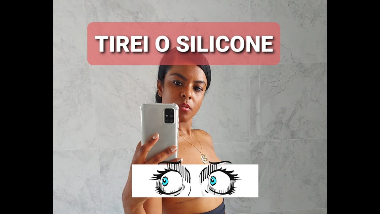 TIREI O SILICONE - Fotos antes e depois - YouTube