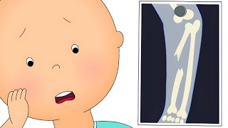 🦴 Caillou Breaks a Bone 🤕 | Caillou's New Adventures