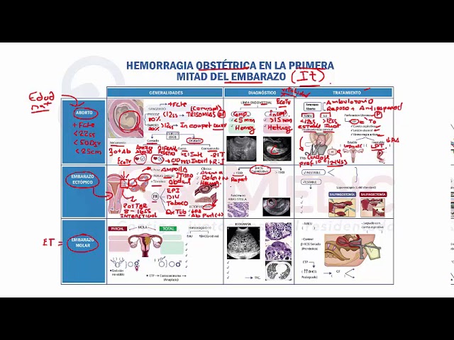 MAPA MENTAL HEMORRAGIA 1° MITAD DEL EMBARAZO QX MEDIC RM 2020 - YouTube