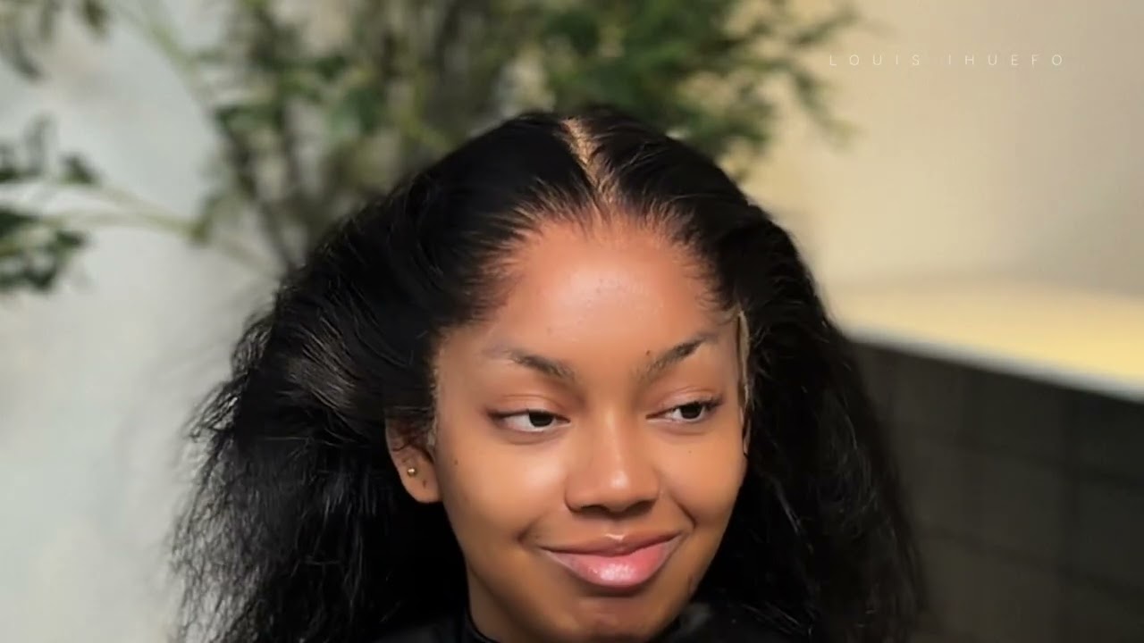 FRONTAL INSTALLATION