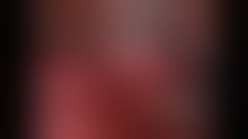 Asvide: Right upper lobe posterior (S2) segmentectomy