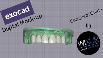 Exocad - Digital Mock-up