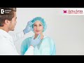 Consultation for Rhinoplasty | Why Is This Important Before Surgery | Dr. Girish A C