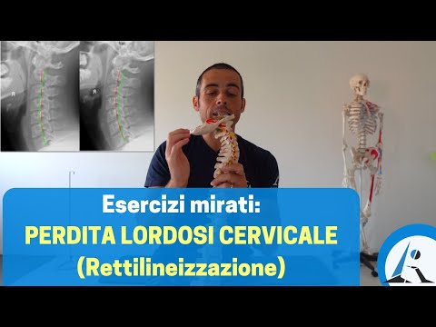 Video: 3 semplici modi per trattare il raddrizzamento della colonna cervicale