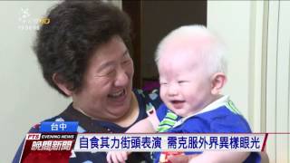 全台首個白化症家庭 白化症夫妻生兩子 20170519 公視晚間新聞