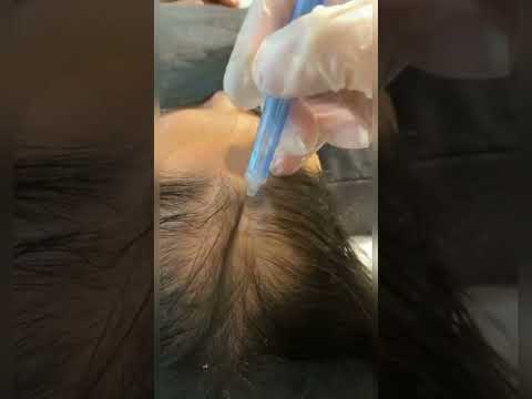 Video 1