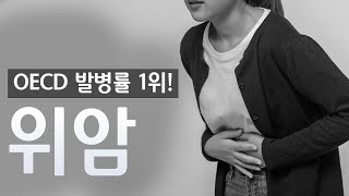 우리는 지금 위암과 소리 없는 전쟁 중! &#39;위암&#39; Ι 가톨릭대학교 대전성모병원 위장관외과 유한모 교수 Ι 건강플러스
