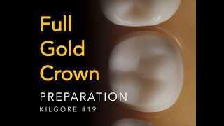 Full Gold Crown #19 Kilgore | Full Metal Crown Preparation