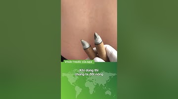 4 cách chữa đau lưng bằng lá ngải cứu - Xem ngay