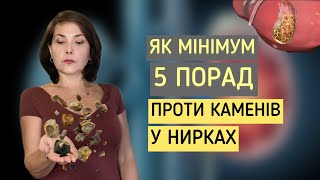 Як мінімум 5 порад проти КАМЕНІВ У НИРКАХ! / Dr. Ruslana Borysenko