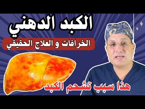 علاج سموم الكبد الدهني شرح رائع لعلاج تشحم الكبد واعراضه بدون ادويه