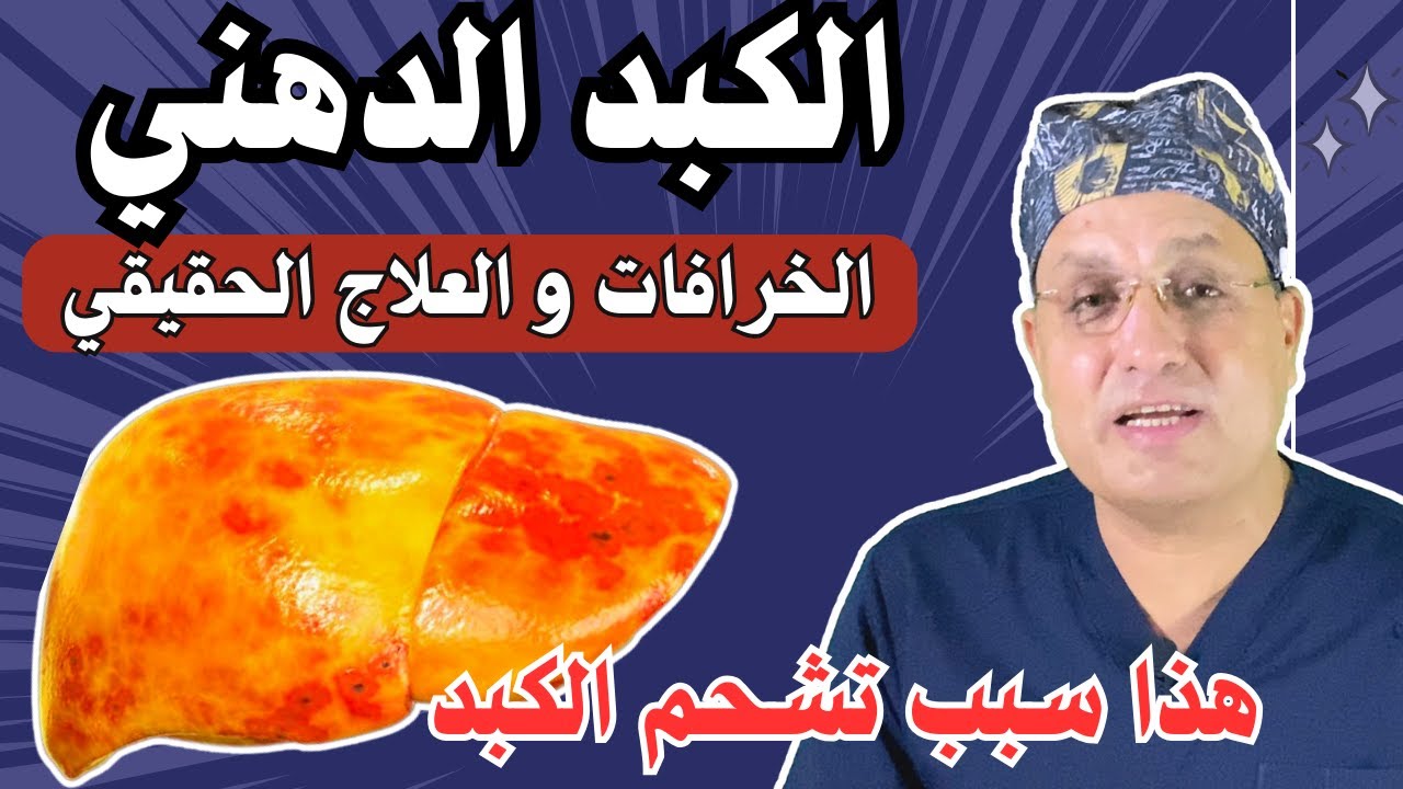 علاج سموم الكبد الدهني | شرح رائع لعلاج تشحم الكبد واعراضه بدون ادويه !