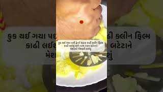 | બટેટાની સ્વાદિષ્ટ અનોખી વાનગી | potato |