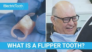 What is a flipper tooth?