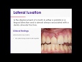 11. Traumatic Dental Injuries: Part 2: Luxation Injuries, Type 4: Lateral Luxations