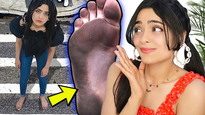 قضيت يوم كامل بدون حذاء 🥿 رجلي احترقت ....