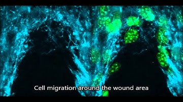 Cellular forces and matrix assembly coordinate fibrous tissue repair