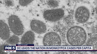 At 122 cases, D.C. has the highest rate of monkeypox per capita in US says Health Director