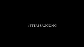 Fettabsaugen Der Spezialist Fur Manner In Zurich