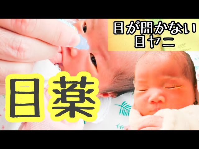 目やに 目が開かない新生児赤ちゃんに目薬点眼 結膜炎 鼻涙管閉塞症 Youtube