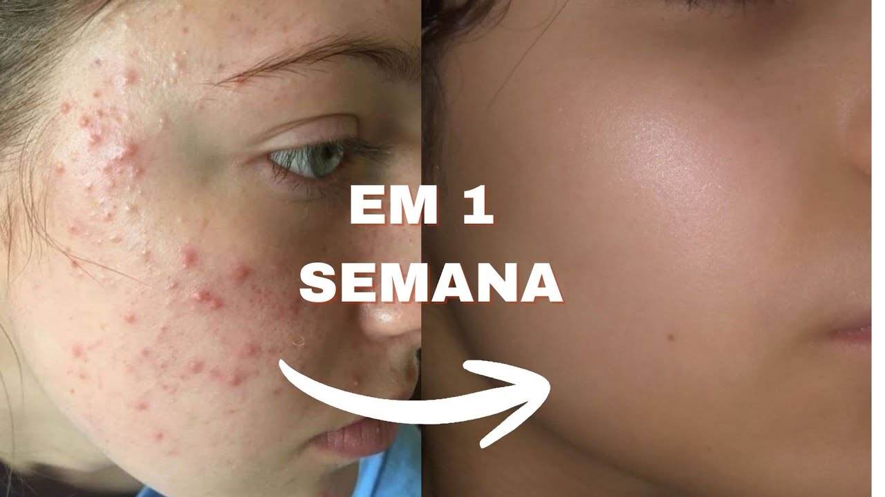 COMO MUDAR SEU ROSTO EM 7 DIAS