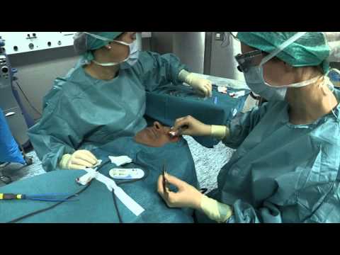 Video: Ptosis - Behandeling, Oorzaken, Operatie