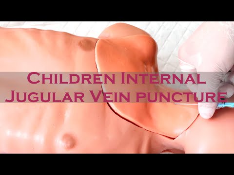 Пункція Внутрішньої яремної вени у дитини / Children Internal Jugular Vein puncture ENG subtitles