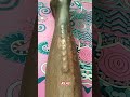 bagian dari fase pemulihan patah tulang tibia & fibula