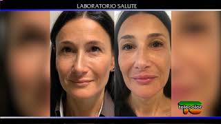 Laser a CO2 frazionato, Yamuna® Body Rolling e Triptherapy 24.10.2019