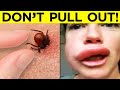 खतरनाक कीड़े अगर कभी आप पर अटैक करे तो क्या करें ! | Dangerous Bugs and What to Do If They Attack You