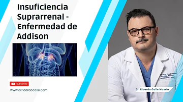 ¿Pueden aparecer y desaparecer los síntomas de la enfermedad de Addison?