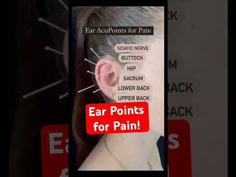 Ear Acupuncture for