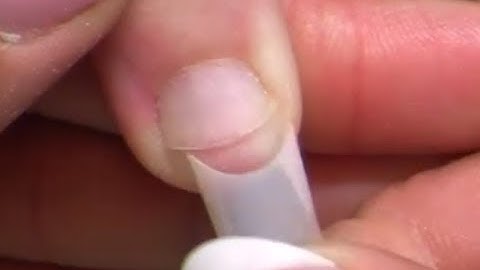 Nail Biter Tip Application