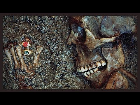 Why the Romans had Better Teeth than Modern Europeans