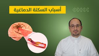 أهم أسباب السكتة الدماغية