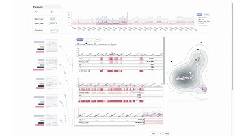 CloudDet: Interactive Visual Analysis of Anomalous Performances in Cloud Computing Systems